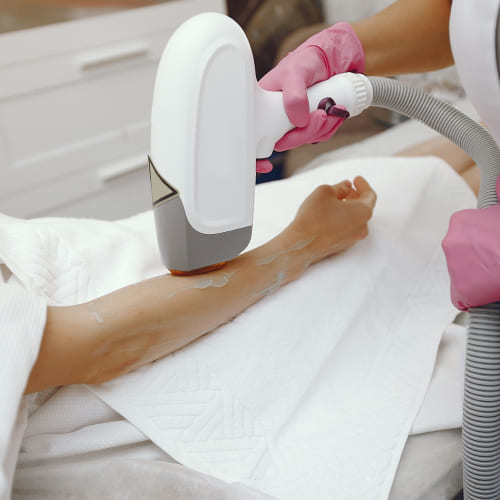 IPL Hair Removal Device